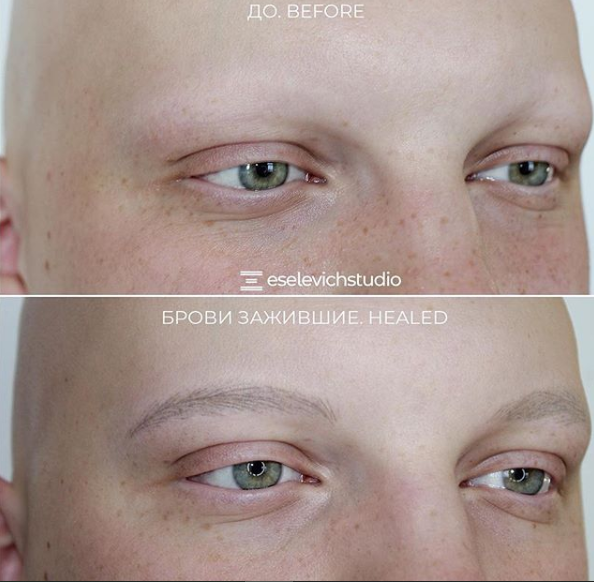 Instagram eselevich_natalya. Волосковая аппаратная техника