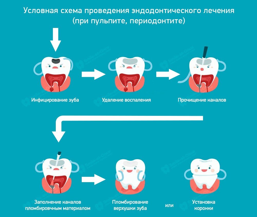 Что делать, если болит зуб? Причины, виды зубной боли, методы избавления от зубной боли.