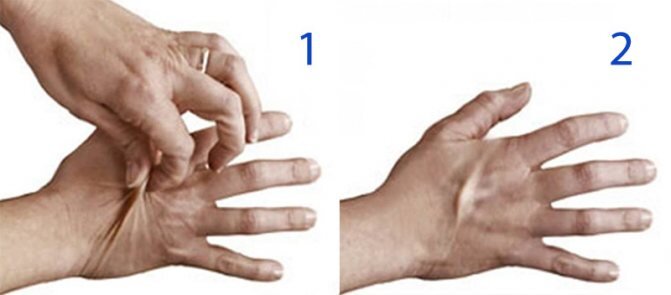 Фотография с ресурса ЯНДЕКС.КАРТИНКИ. Вялость тургора.