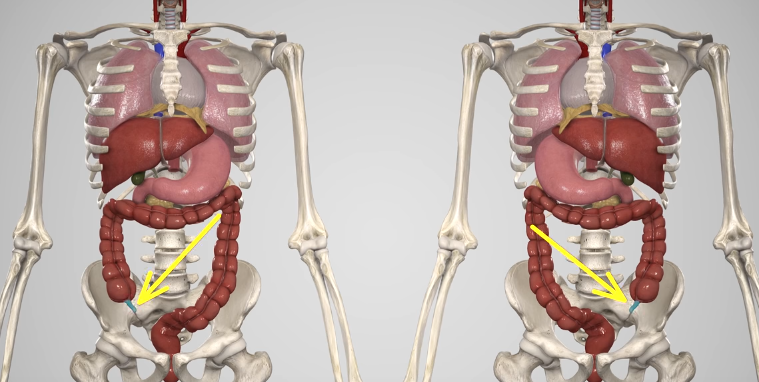 Зеркальное расположение органов человека