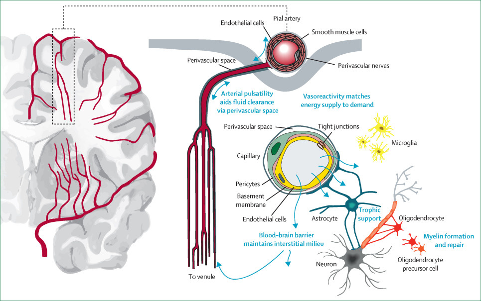 Ухудшение здоровья мелких кровеносных сосудов приводит к увеличению риска деменции