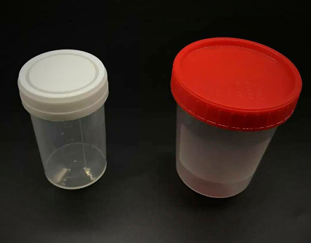 Проверьте мочу