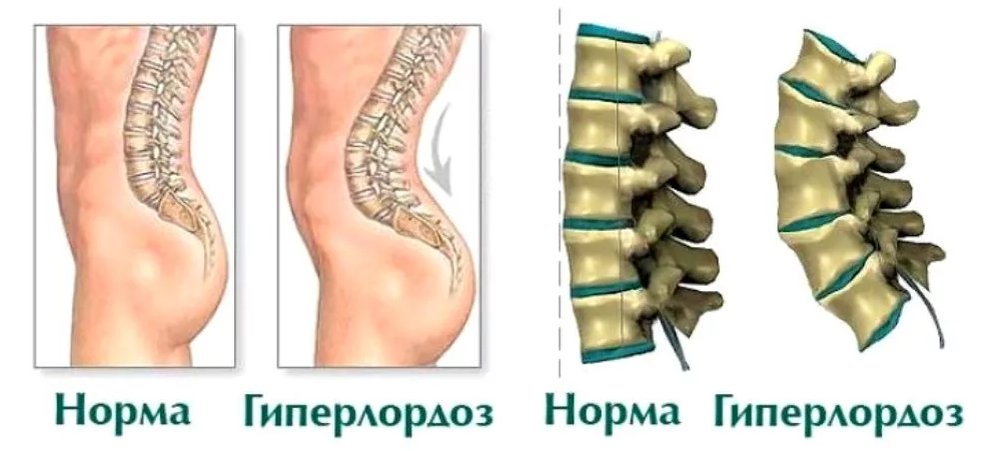 ᐈ Симфизит ~【Симптомы, причины, лечение в Киеве】