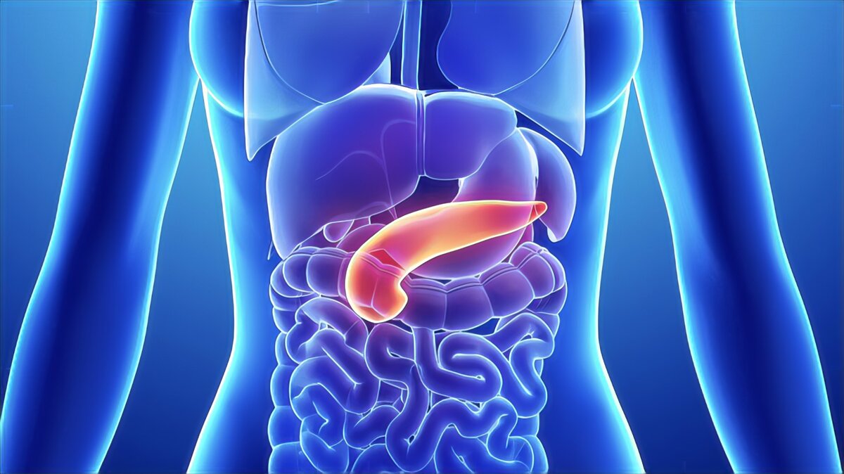 Дуоденоилео-шунтирование. Конкременты в поджелудочной железе. Ожирение поджелудочной лечение. Ожирение поджелудочной лечение. Заболевание поджелудки.