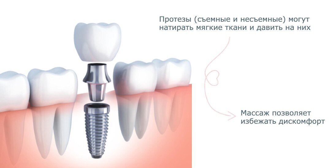 Массаж десен при прорезывании зубов (позаимствовала)