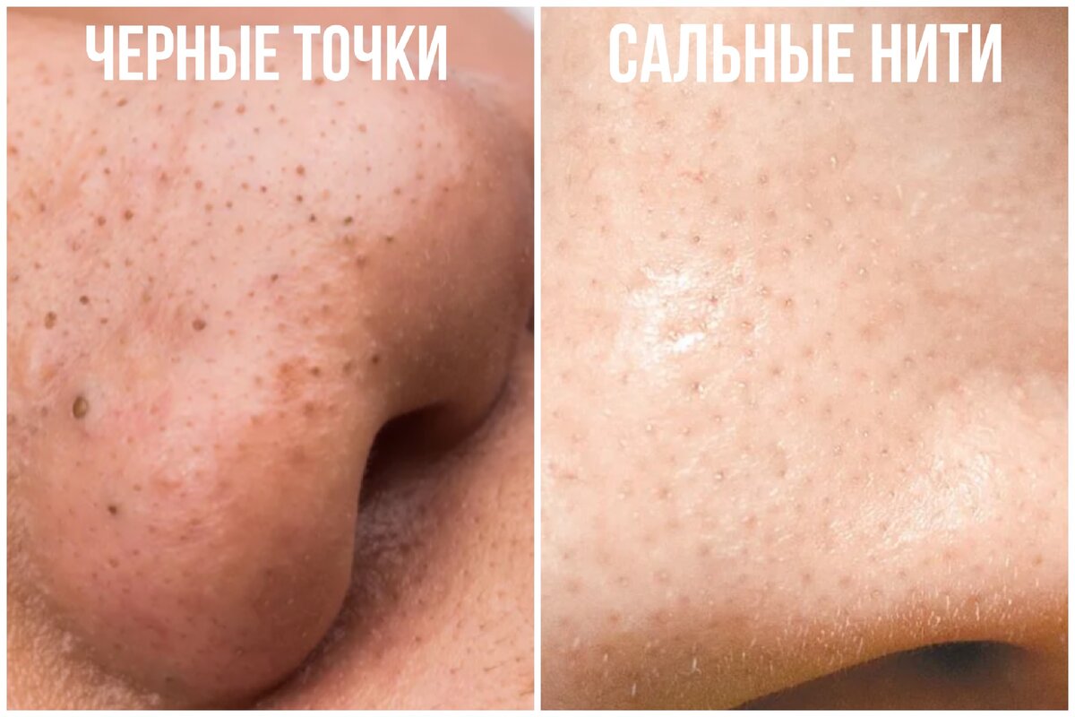 Фото взяты из Яндекс.Картинок исключительно для наглядности 