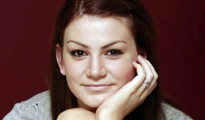 Эшли Моррис — аллергия на воду.
