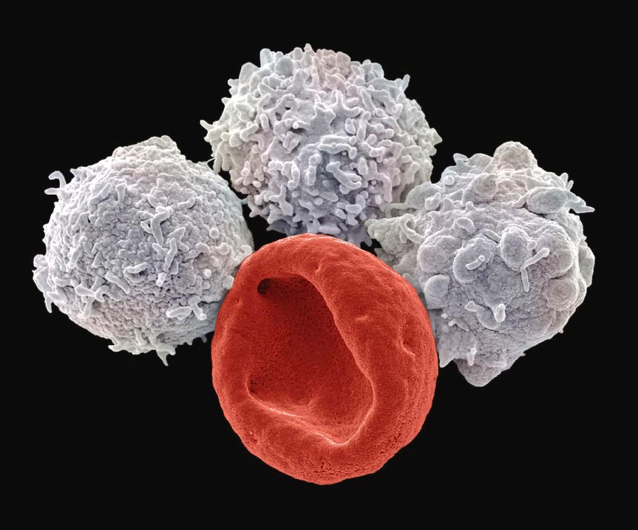 Как называются белые клетки. Лейкоциты фото. Эритроциты электронная микрофотография. Лейкоциты белые кровяные тельца. Нарисовать эритроциты лейкоциты тромбоциты.