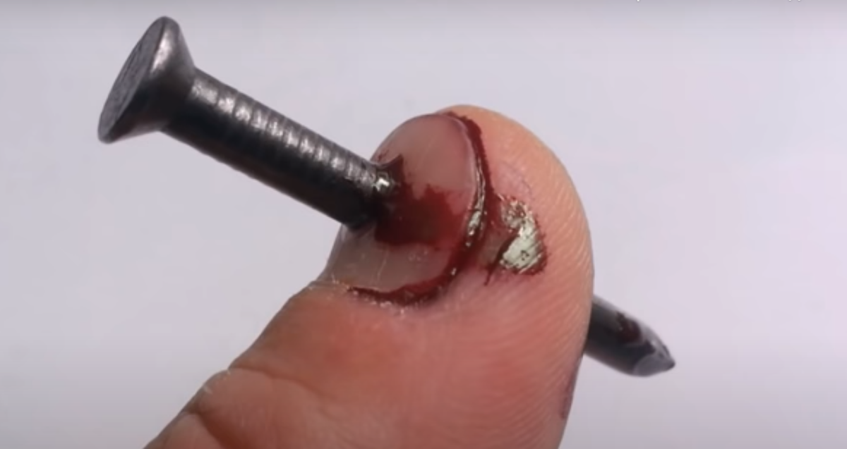 Не проделывайте таких манипуляций со своим пальцем или жизнью