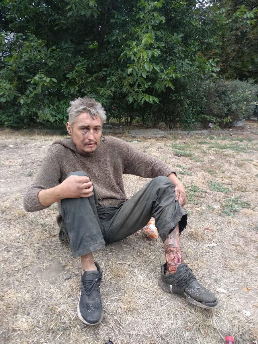 Год назад. Таким его забирали с улицы