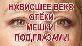 Нависшие веки! Отёки! Мешки под глазами! Исчезнут просто быстро навсегда!