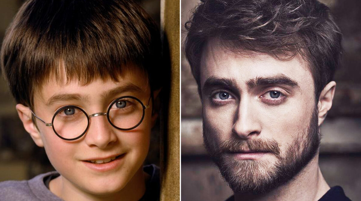 Мальчик вырос... Да и шрам на лбу уже зажил...