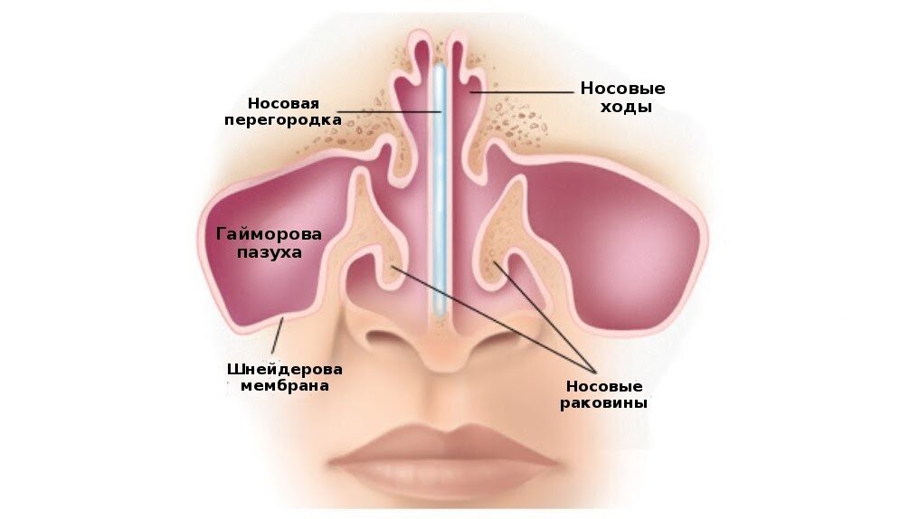 Зачем лор отправляет на лечение к стоматологу, или Как связаны больные ...