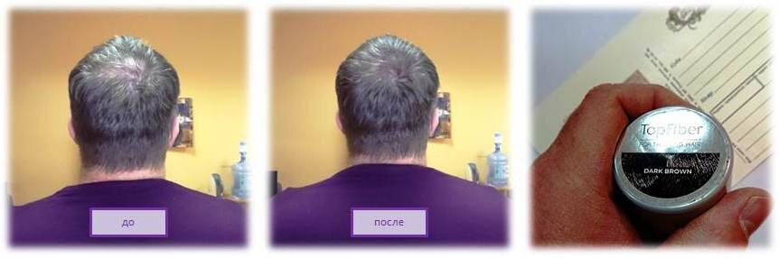 Макушка моей головы до и после использования загустителя волос.