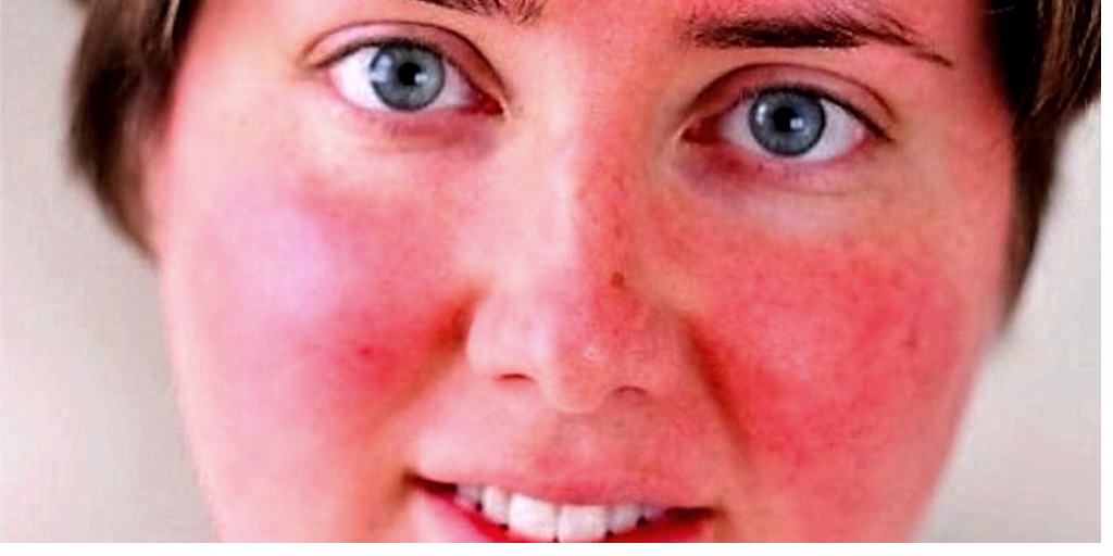 Беременная женщина часто испытывает приливы жара.