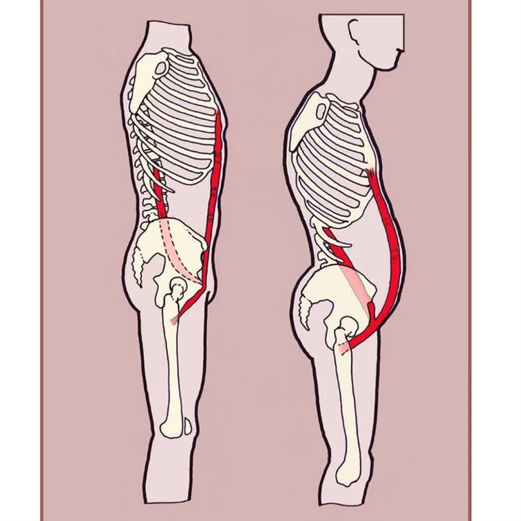 Гиперлордоз и выпирающий живот. Подвздошно-поясничная мышца анатомия. Пояснично-подвздошная гиперлордоз. Растяжка подвздошно-поясничной мышцы. Подвздошно-поясничная мышца анатомия упражнения.