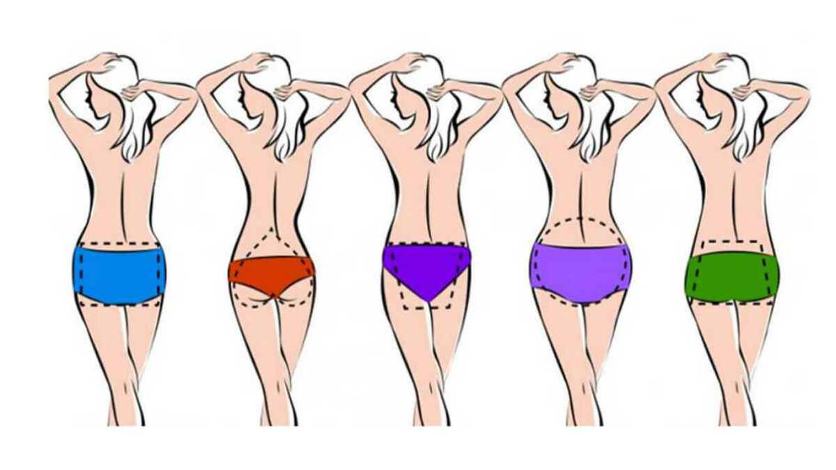 Формы ягодиц