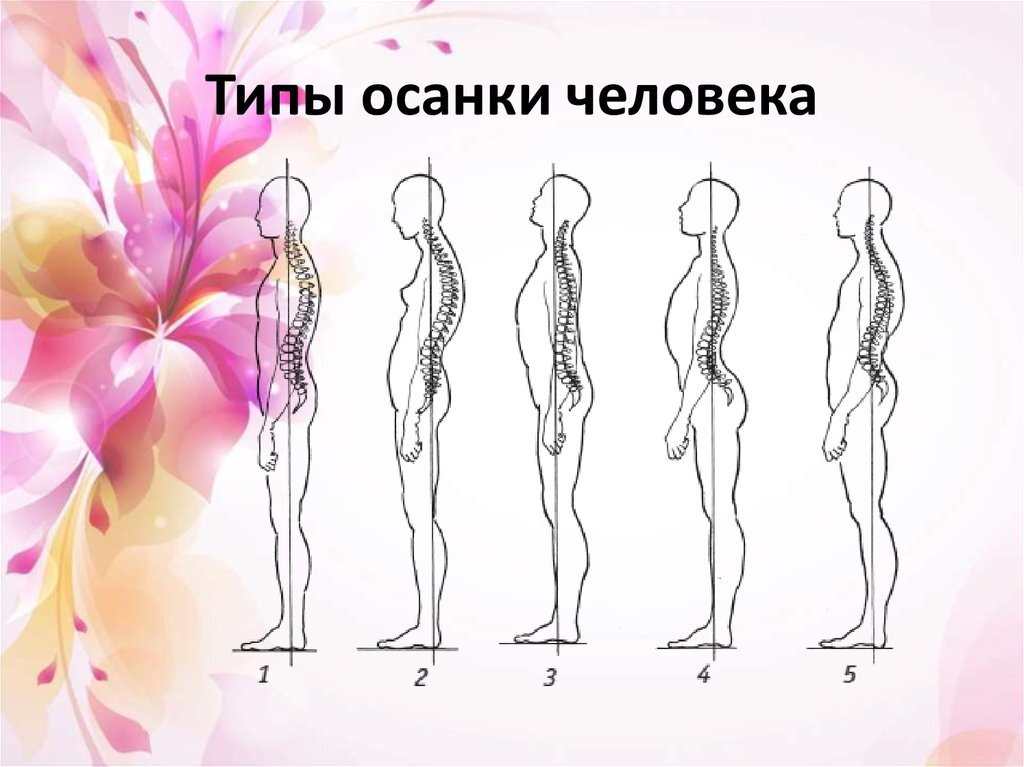 Осанка человека картинка