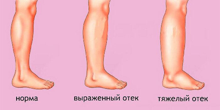 Из интернета 