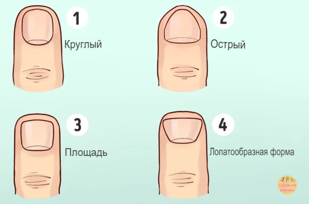 Какая форма ногтей подходит пальцам. Форма ногтей и характер. Лопатообразная форма ногтей. Характер по форме ногтевой пластины. Правильная форма ногтя сбоку.