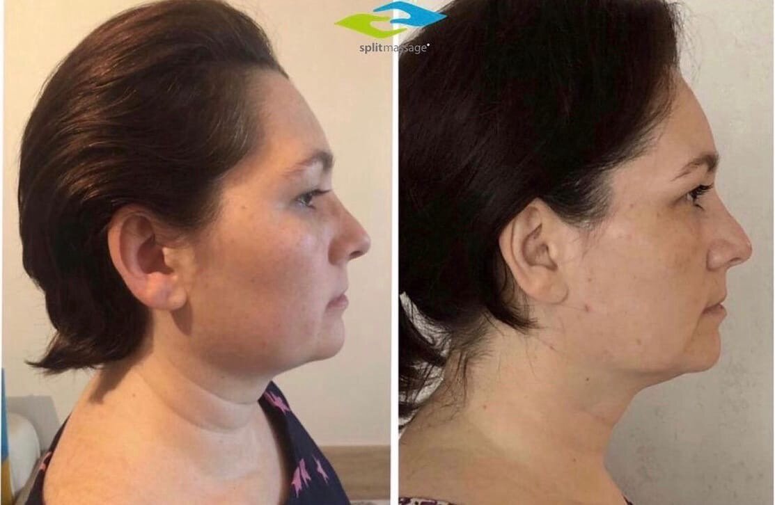 Институт Сплитмассаж #ссплитмассаж#молодостьикрасота #здоровьеженщины 