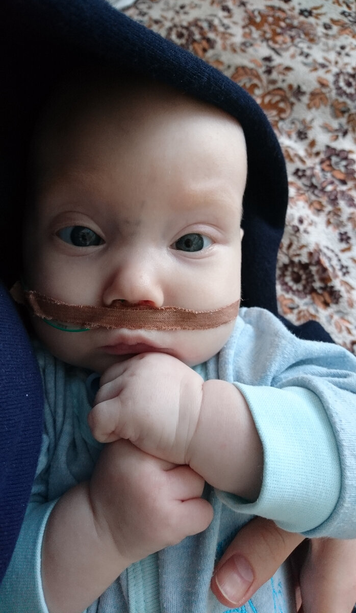 Зонд, который помогал сыну съедать норму и хоть немного набирать вес