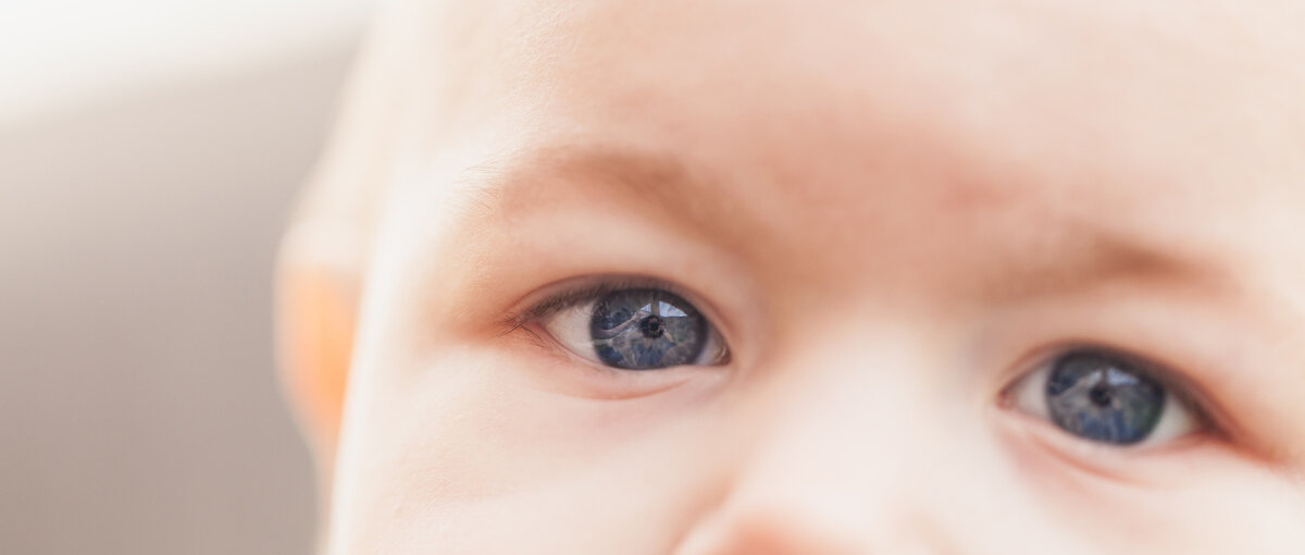 Закисает глаз у новорожденного: причины и решение | Nestle Baby
