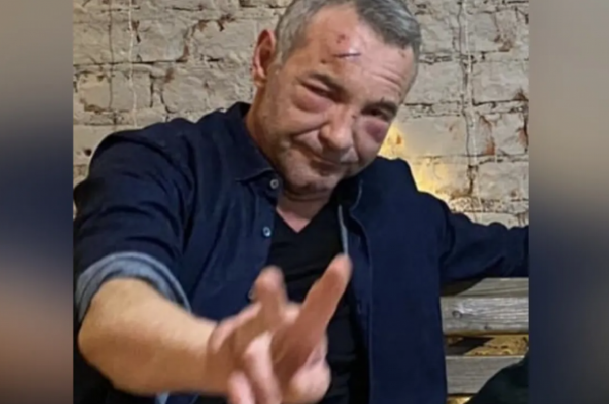 Актер из «Бандитского Петербурга» рассказал, откуда у него травмы | АиФ ...