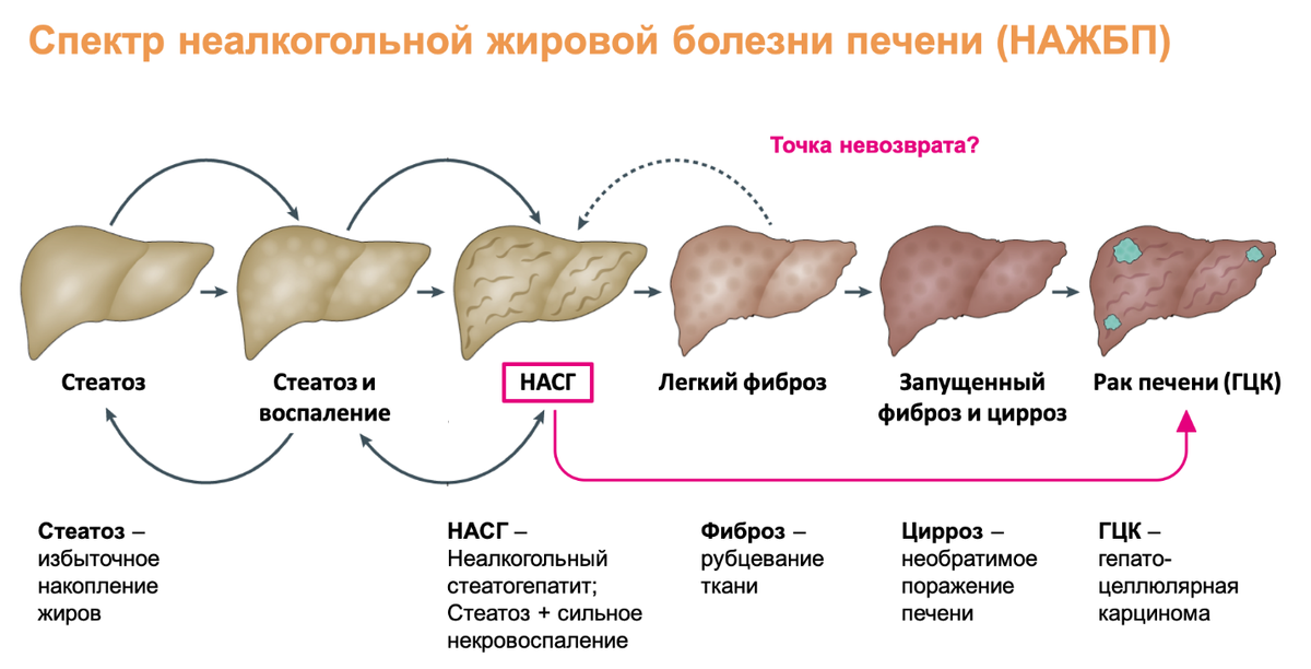 Гистологическим признаком нажбп