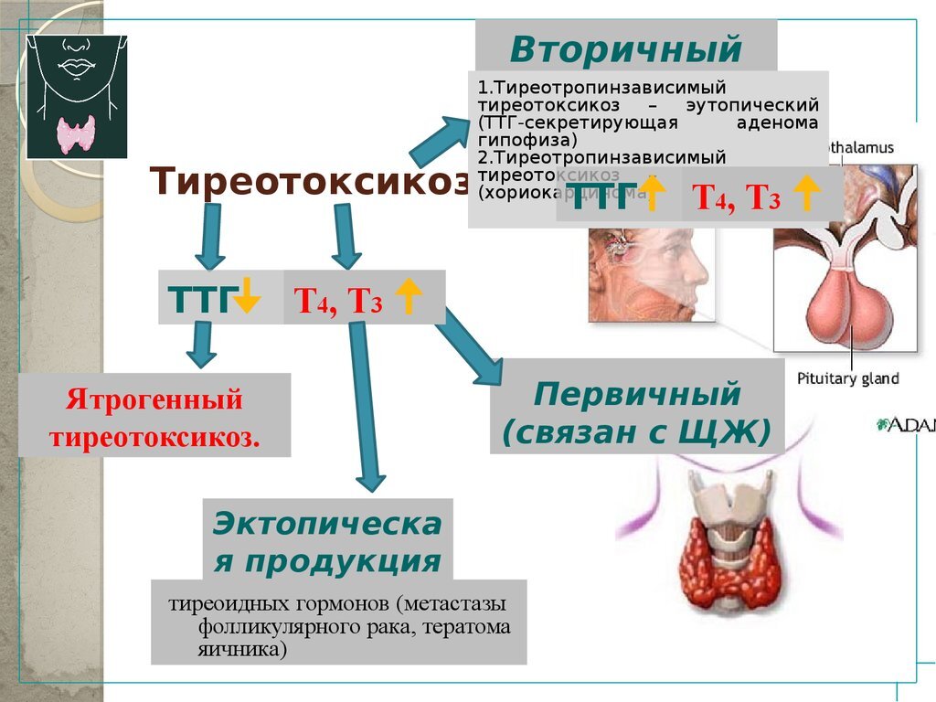 Схема механизмов развития висцеропатической стадии тиреотоксикоза