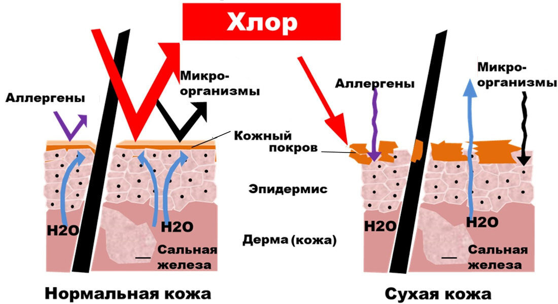 Как хлор раздражает кожу человека