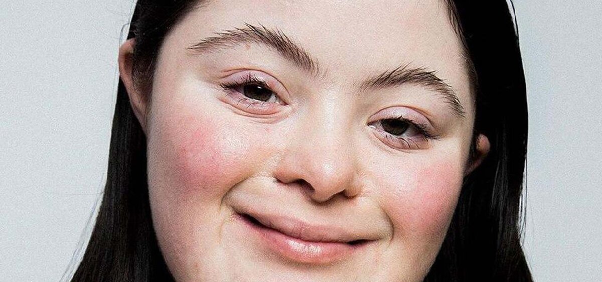 https://www.ilsussidiario.net/news/ellie-goldstein-prima-modella-gucci-con-sindrome-di-down-orgogliosa-degli-scatti/2043039/
