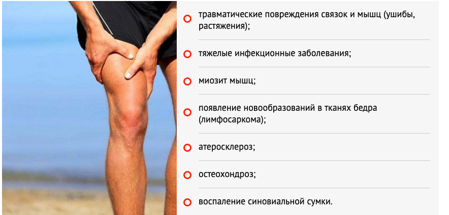 Боль в икрах ног причины у мужчин. Боль в тазобедренном сбоку с внешней стороны бедра. Болит мышца бедра спереди левой ноги. Боль в бедренной мышце спереди. Боль в бедре сбоку с внешней стороны.