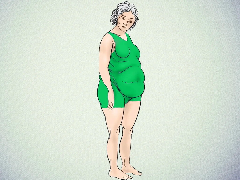 надпочечниковый тип 