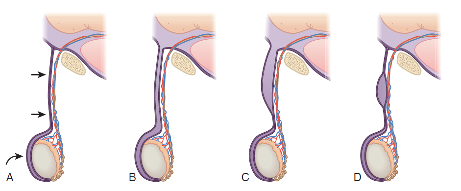 Объяснение в тексте                            CAMPBELL-WALSH UROLOGY, ELEVENTH EDITION 