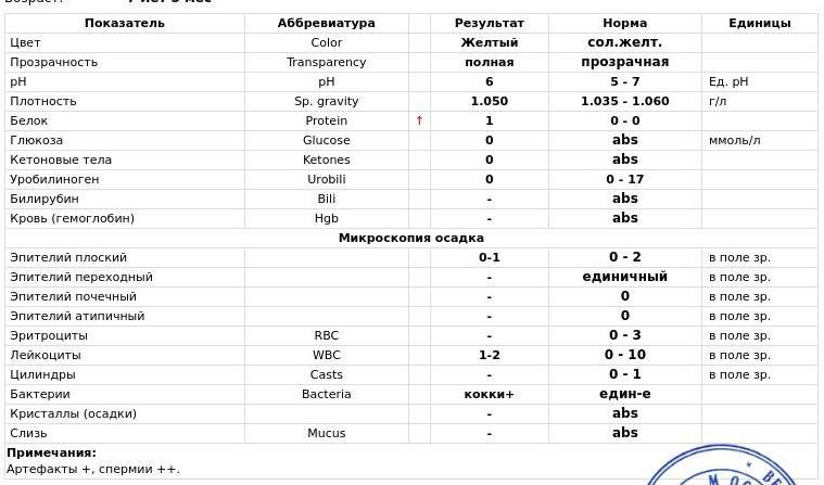 Причины появления полиурии