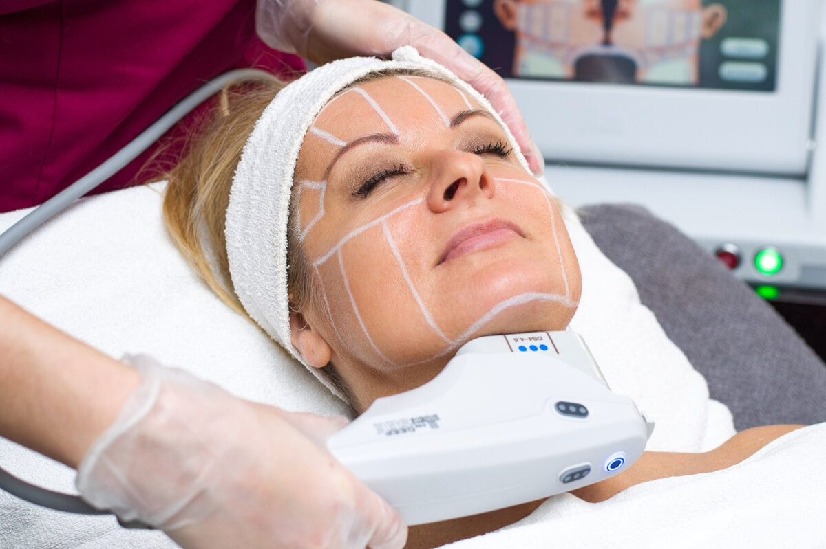 SMAS-лифтинг в Самаре: полный обзор процедуры