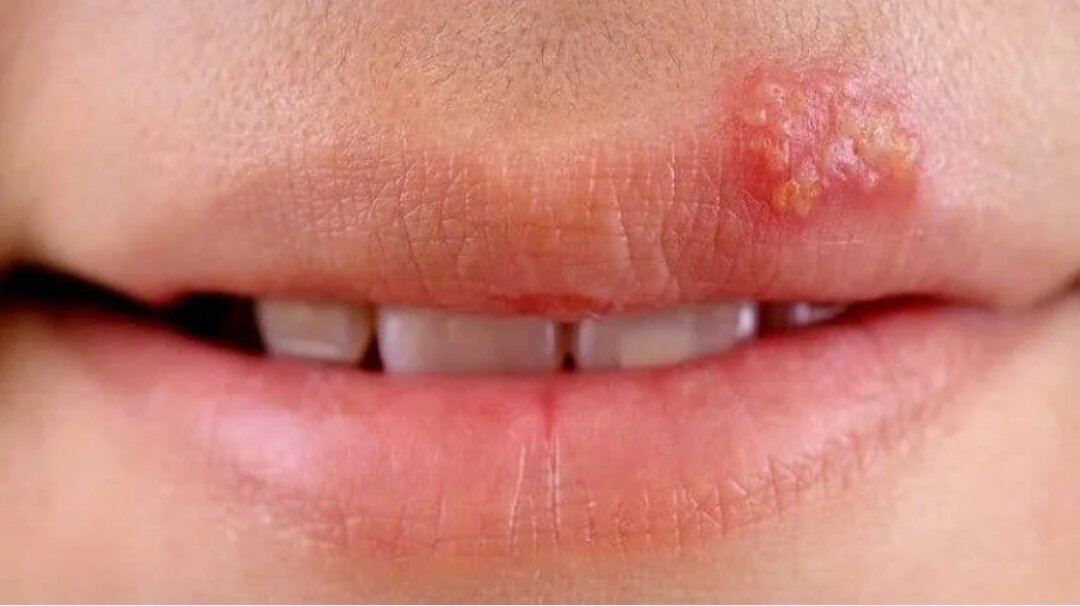 Фото взято с отрытых источников