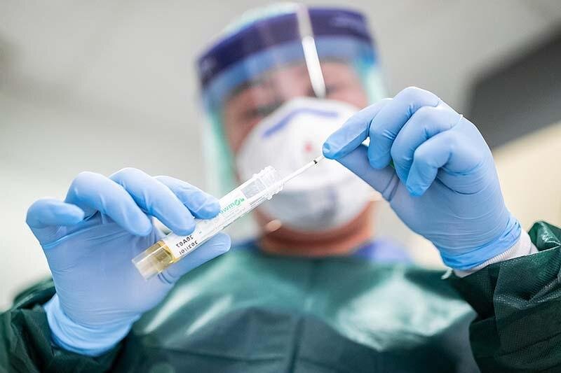 Это так называемые последствия после коронавируса, которые проявляется через несколько месяцев. То есть человек, который переболел covid-19  и вернулся к нормальной жизни, через пару месяцев получает последствия. Некоторые думали, что это индивидуально, однако эти симптомы проявляются все у большего количества людей. Блюда могут быть как молочные продукты, так и мясные, даже алкогольные и некоторые фрукты. И из-за этого люди должны менять рацион пищи, так как не в силах употреблять то, что ели до этого. 