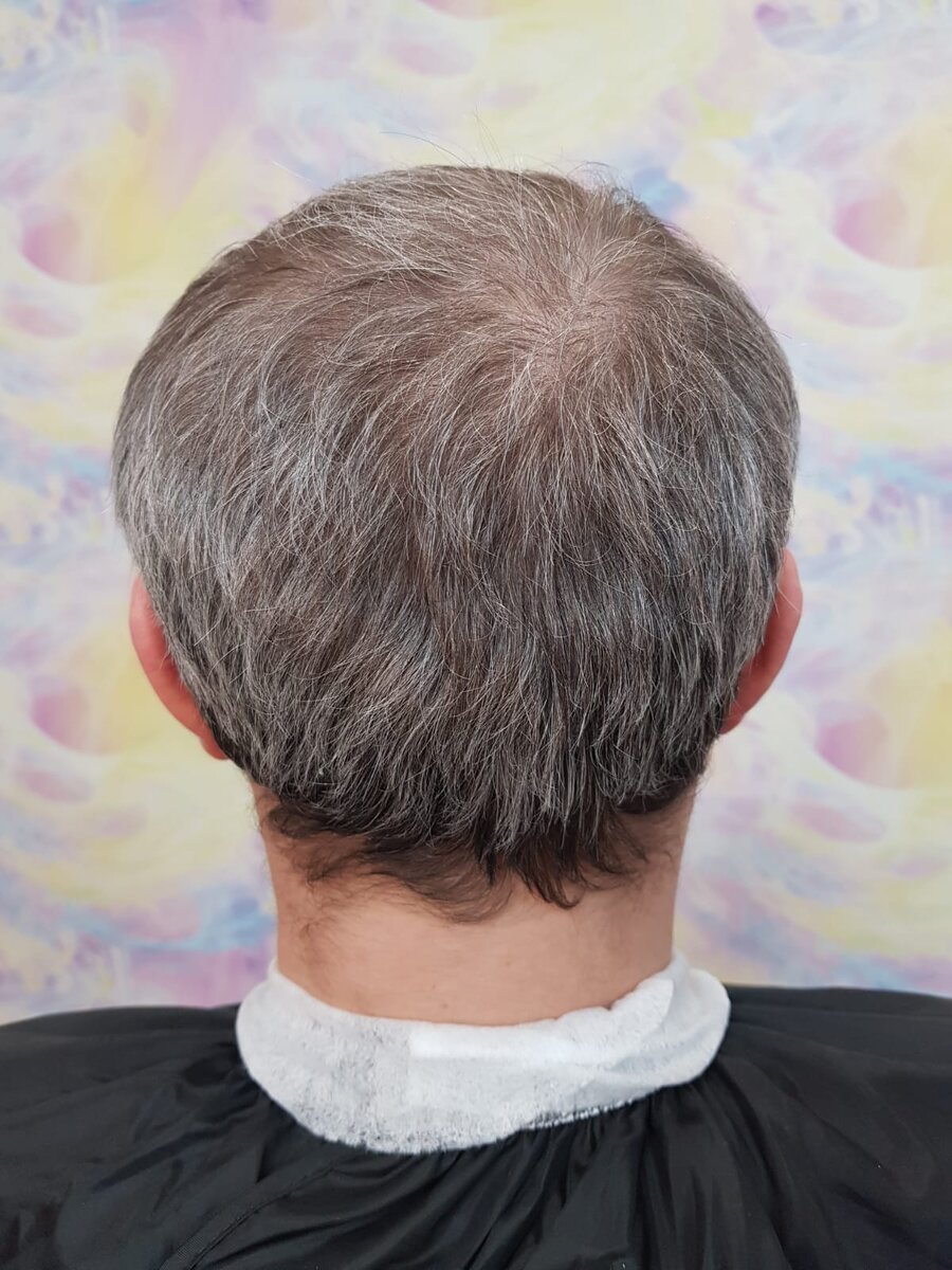 До процедуры