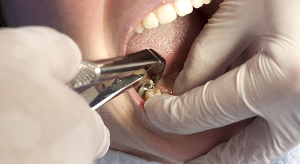 ...Стоматологи относятся к самой высокой группе риска по инфицированию теми или иными заболеваниями. Исследования в США показали, что в среднестатистической стоматологической практике на прием к стоматологу каждые два дня приходят пациенты, являющиеся носителями вируса гриппа, каждые 3 дня — герпеса, каждые 4 дня — кожных или венерических заболеваний, каждые 5 дней — гепатита. Если бы проводились исследования заболеваемости гриппом детей стоматологов, то наверняка результаты также были бы неутешительными...