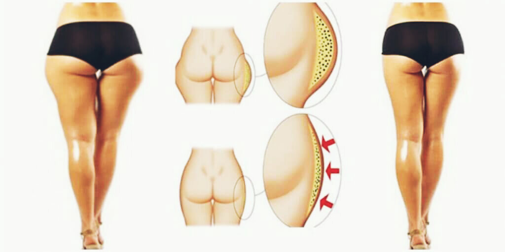 Наследственность тоже можно убрать.