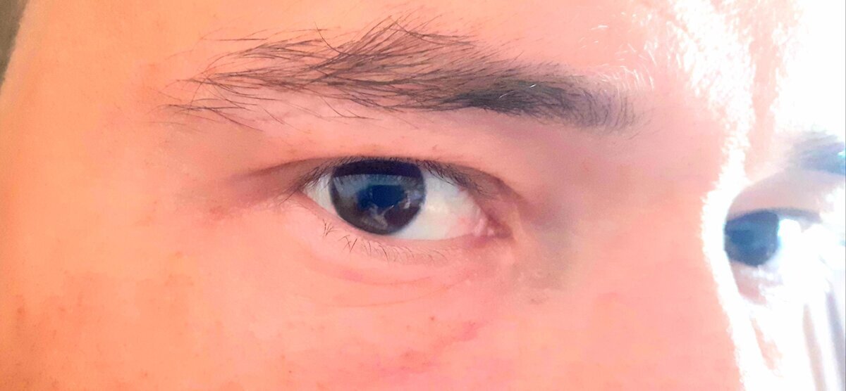 Зрение очень важно для любого человека и им нужно дорожить.