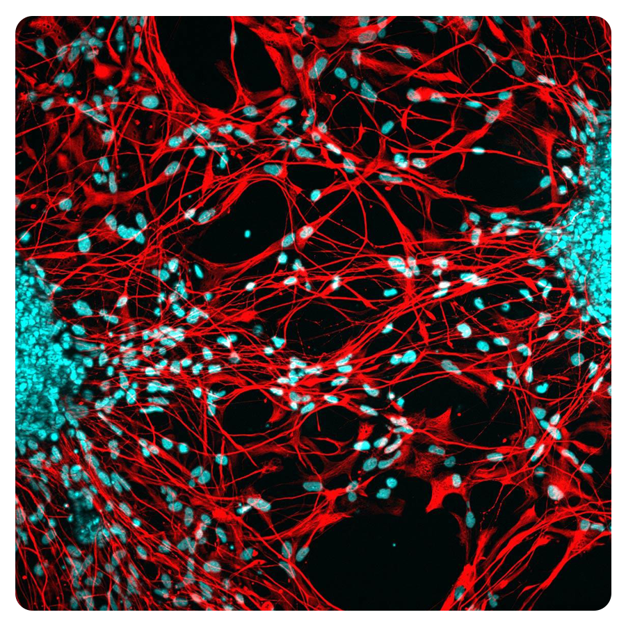 Аксоны нейронов (красные) из органоида человеческого мозга в лабораторных условиях. Их ядра окрашены в синий цвет.