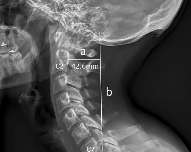 Врожденные аномалии