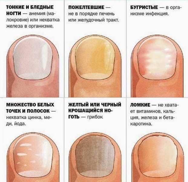Картинка взята из интернета