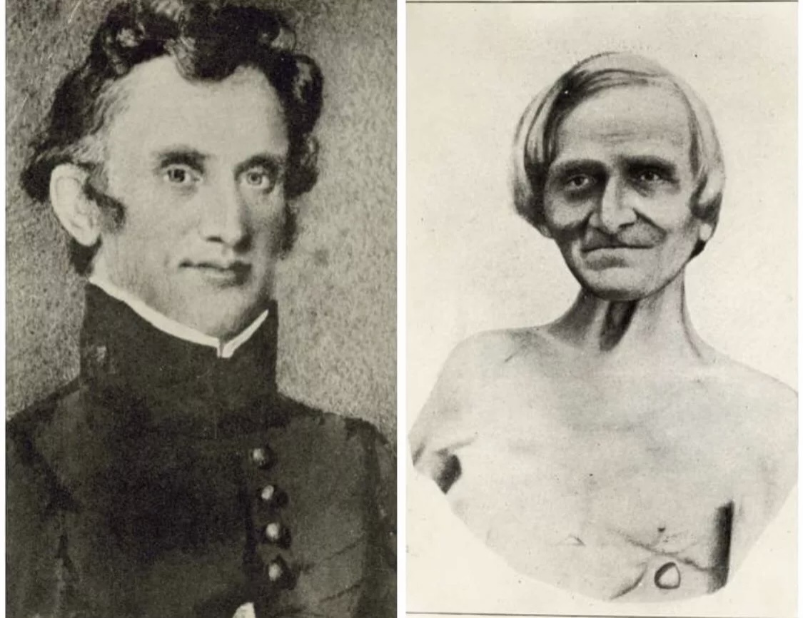 Уильям Бьюмонт и Ст. Мартин