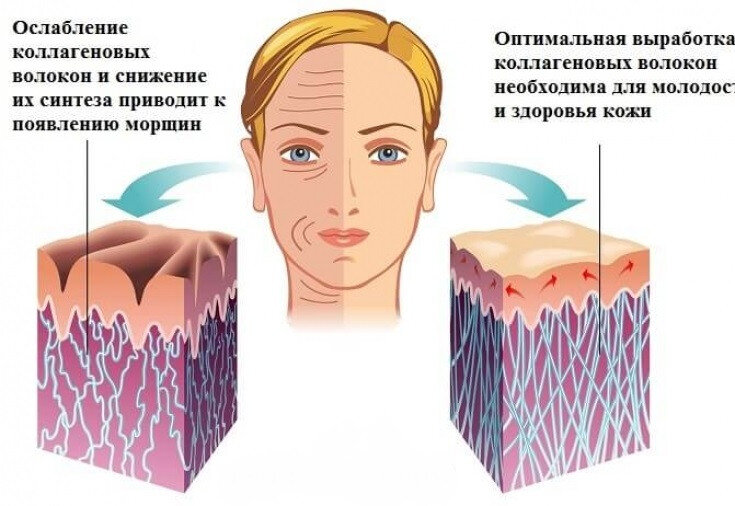 как выглядит кожа при недостатки коллагена(слева) и как выглядит кожа при достаточном количестве коллагена. 