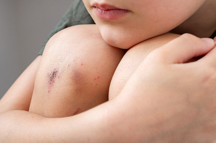 Фото: Getty Images 