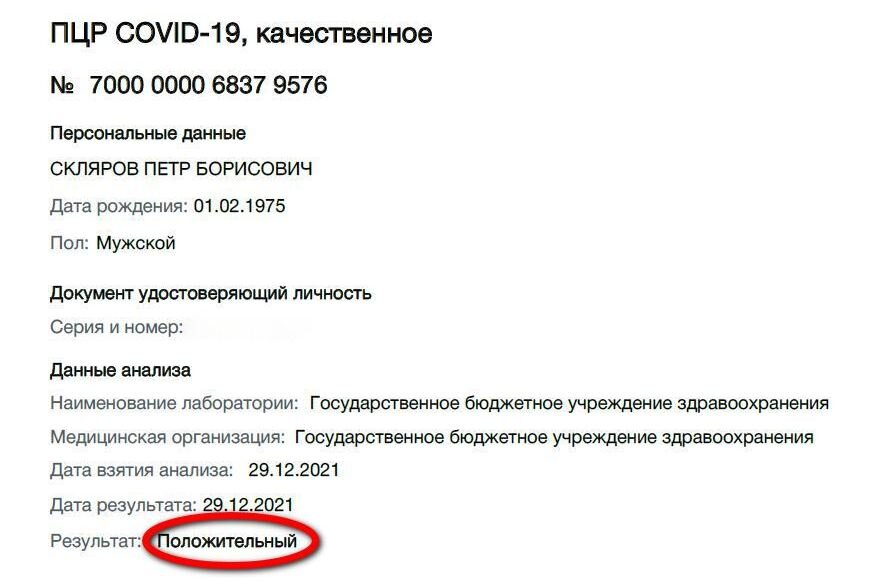 Результат моего ПЦР-теста